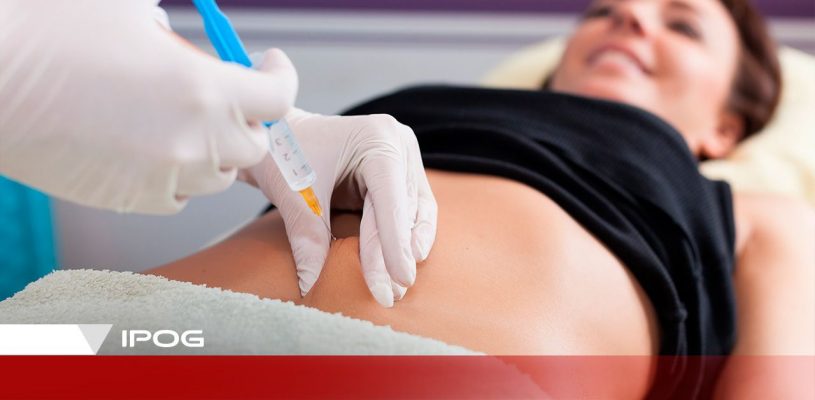 Mesoterapia: conheça o tratamento estético que tem inovado o setor